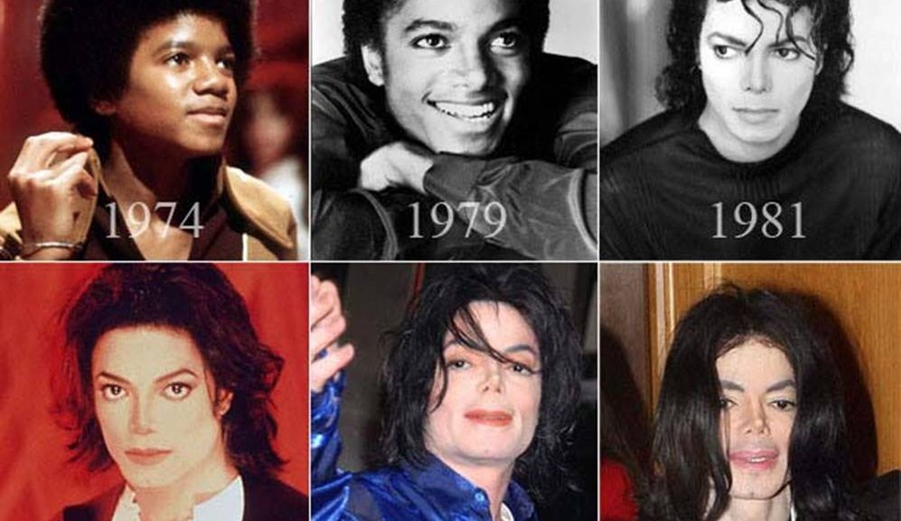 Michael Jackson Before and After