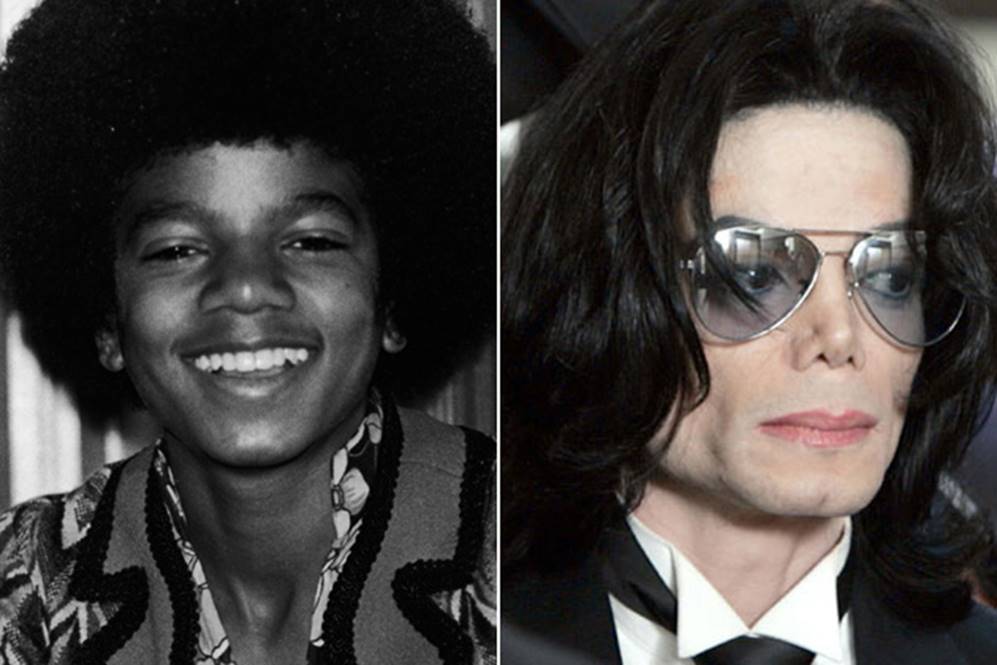 Michael Jackson Before and After