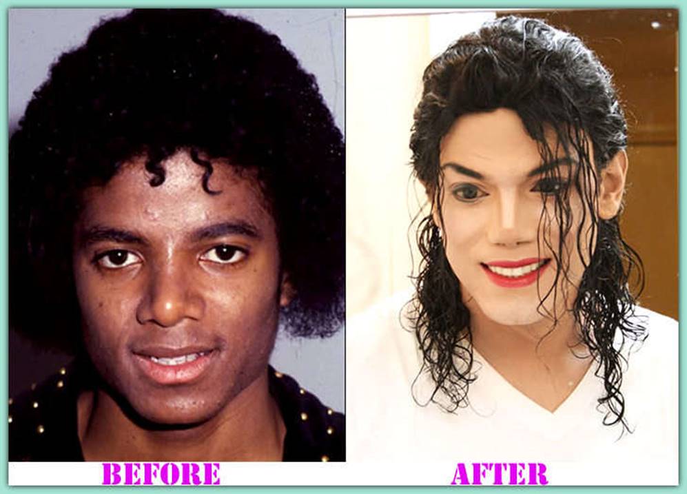 Michael Jackson Before and After