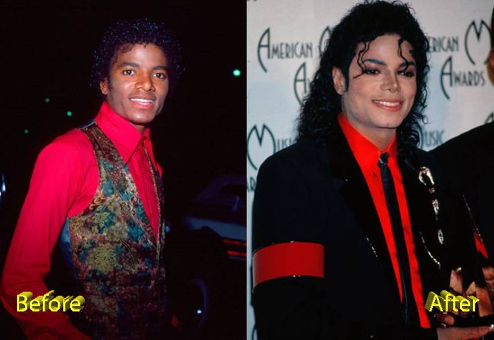 Michael Jackson Before and After