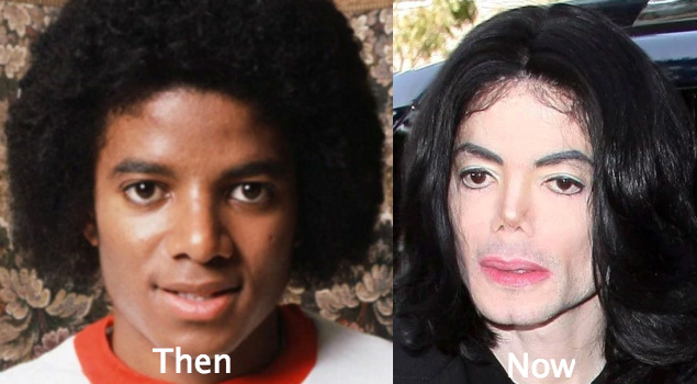 Michael Jackson Before and After