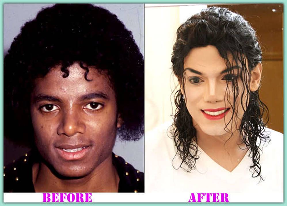 The Unfettable Michael Jackson Before And After Plastic Surgery Pictures La...